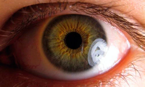 Кому грозит возрастная глаукома?